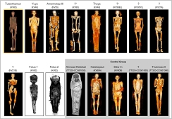 ©JAMA - Examined mummies