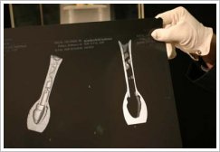X-ray image of Hatshepsut's flacon with dried-up substances, ©Universität Bonn