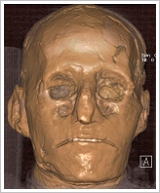 Mummy of Ramses III in 3-D reconstruction, © Albert Zink